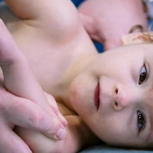 Využití Fascial Manipulation®/Stecco® u neurovývojových poruch v dětském věku